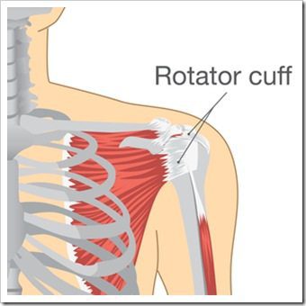 Shoulder Pain Sunnyvale CA Rotator Cuff Injury