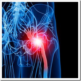 Leg Pain Berwyn PA Sciatica