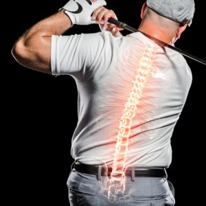 Back Pain New Fairfield CT Sports Injury