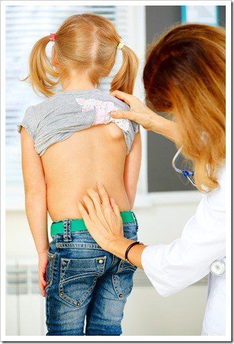 Scoliosis Eatonton GA Pain Relief