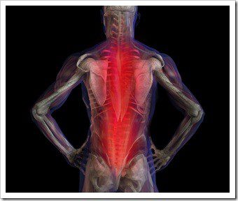 Spinal Stenosis