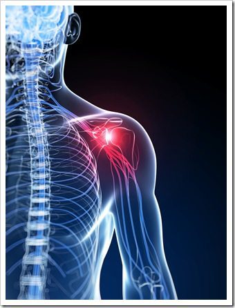 Shoulder Pain Los Angeles CA Rotator Cuff Syndrome