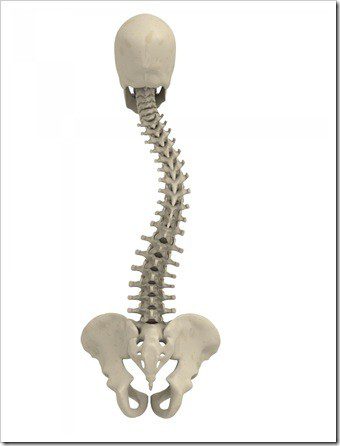 Scoliosis