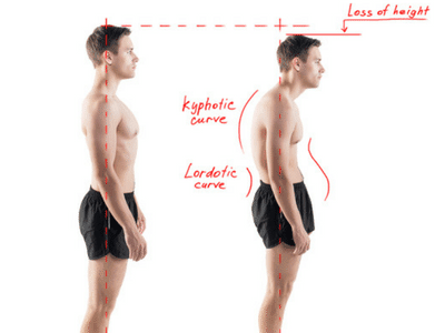 posture-evaluation